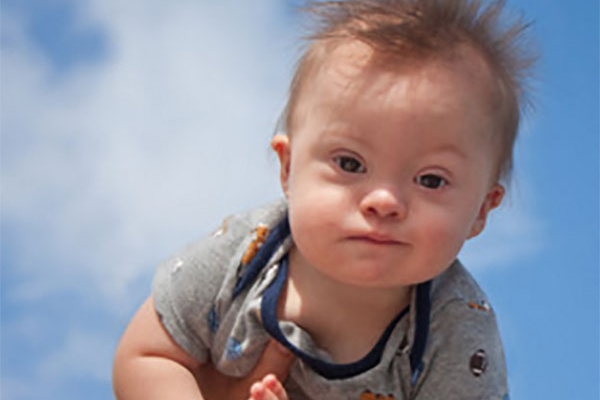 У дитини діагноз « олігофренія »: що це значить