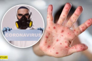 Які види висипу може викликати коронавірус