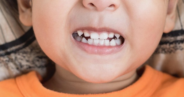 Чому дитина скрипить зубами і як це лікувати