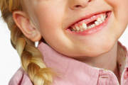 З якого віку починають випадати молочні зуби у дітей