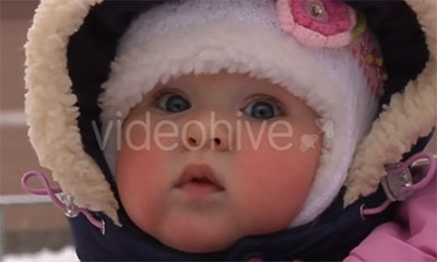 Причини почервоніння щік у дитини