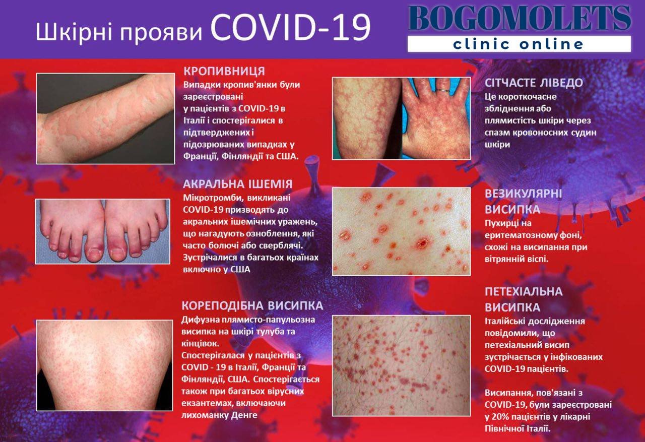 Які види висипу може викликати коронавірус